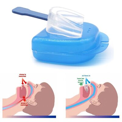 #ad #ad Anti Snore Mouthpiece Aid Stop Snoring Device Apnea Guard Bruxism Sleeping Aids $6.97