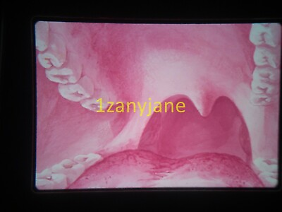 #ad 2A04 Vintage 35MM SLIDE Photo LARYNX MEDICAL OPENING OF MOUTH TONGUE AND TEETH $13.19