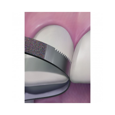 #ad Axis Dental FS3 FX NTI Diamond Strips Fine Grit Serrated 3.75mm 10 Pk $50.57