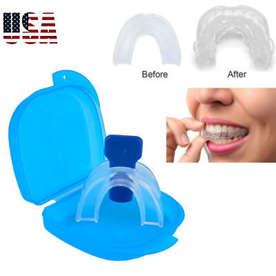 #ad STOP SNORING Mouth Guard Aid Mouthpiece Sleep Apnea Bruxism Anti Snore Grinding $4.70
