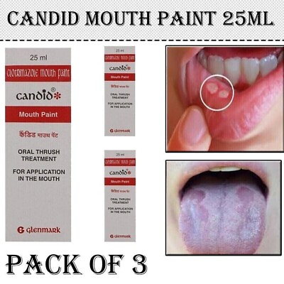 #ad 3 X Candid Mouth Pain For Oral Thrush Treatment For Kills Fungal Infection 25ml. $20.69